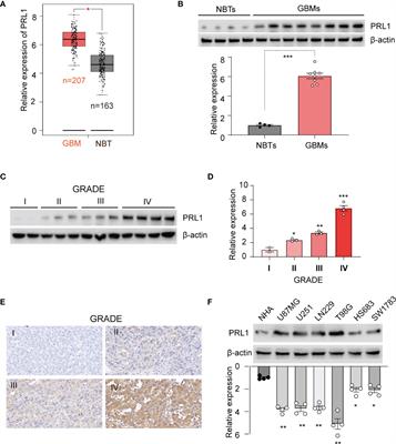 PRL1 Promotes Glioblastoma Invasion and Tumorigenesis via Activating USP36-Mediated Snail2 Deubiquitination